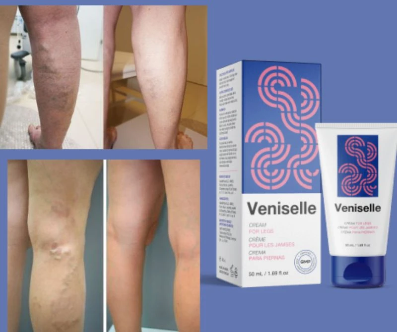 VENISELLE - STOP VARICE